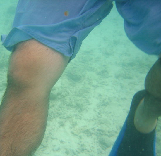 That brown spot against H's shorts-- a baby  jellyfish!